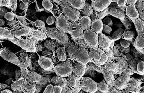 E-coli bacteria