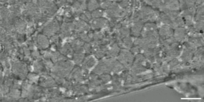 The new iISM microscope allows researchers to see incredible detail inside a live cell without the use of fluorescent labels. This video shows the wiggling tubules of the endoplasmic reticulum and moving vesicles as well as many other processes.