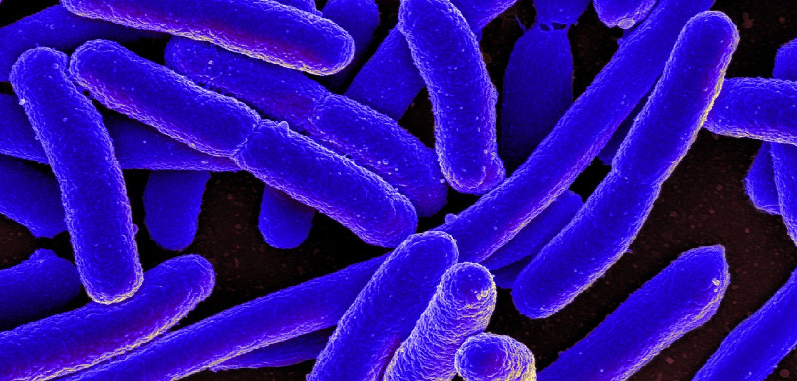 Image of Escherichia coli bacteria
